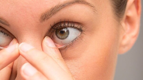 Vệ sinh mắt khi mắt có chất nhầy hoặc mủ