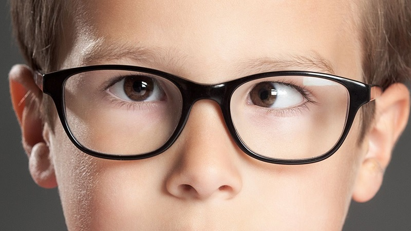 Mắt lác do điều tiết quy tụ xảy ra ở người bị cận thị