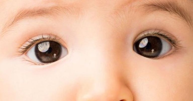 Dấu hiệu nhận biết lác mắt ở trẻ nhỏ